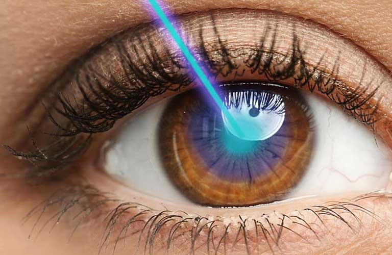 ban laser mat bao nhieu tien