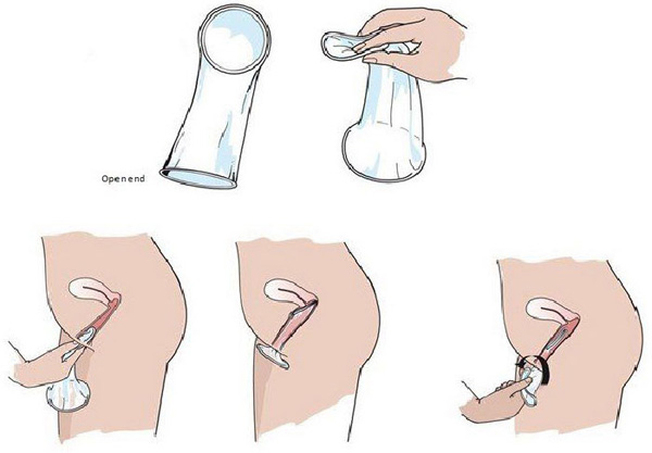 cach-su-dung-bao-cao-su Cách đeo bao cao ѕu đúnɡ cách