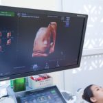 Thai 30 tuần là mấy tháng là băn khoăn của nhiều mẹ bầu.