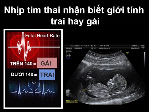 Nhịp tim thai dưới 140 lần/ phút là con trai. Trên 140 lần/phút là con ɡái